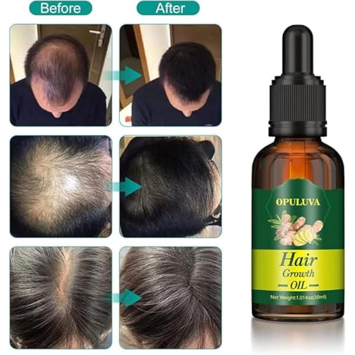 زيت نمو الشعر وملف فراغ الشعر زيت علاج الفراغ وننمو الشعر وزيادة الكثافة وتترطيب منتج طبيعي وآمنة 100% 30مل - Image 5